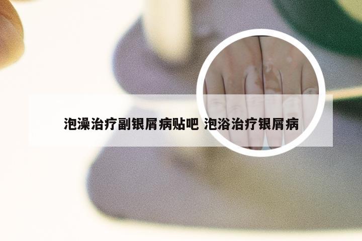 泡澡治疗副银屑病贴吧 泡浴治疗银屑病