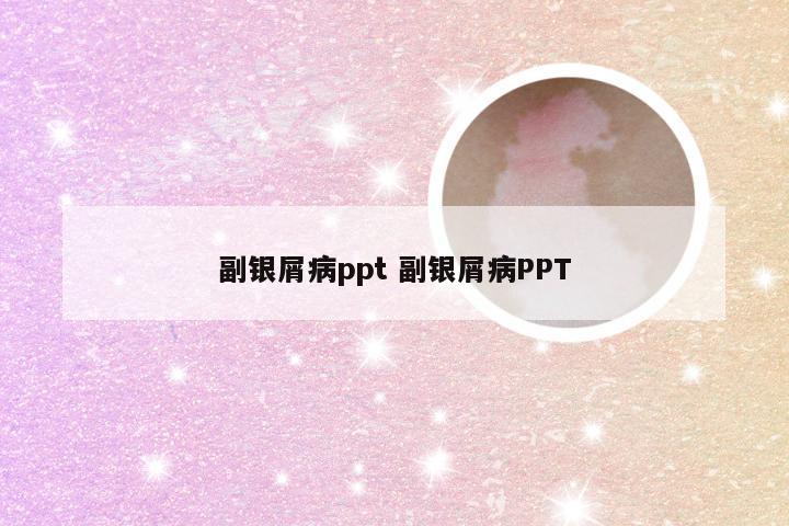 副银屑病ppt 副银屑病PPT