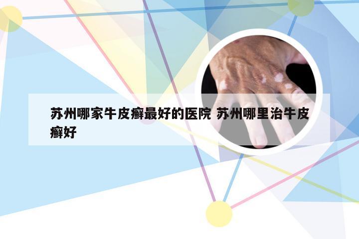 苏州哪家牛皮癣最好的医院 苏州哪里治牛皮癣好