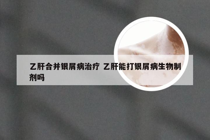 乙肝合并银屑病治疗 乙肝能打银屑病生物制剂吗