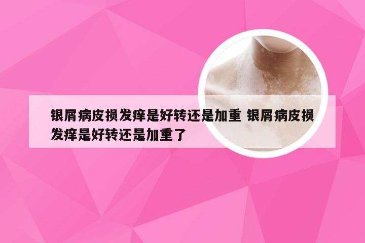 银屑病皮损发痒是好转还是加重 银屑病皮损发痒是好转还是加重了