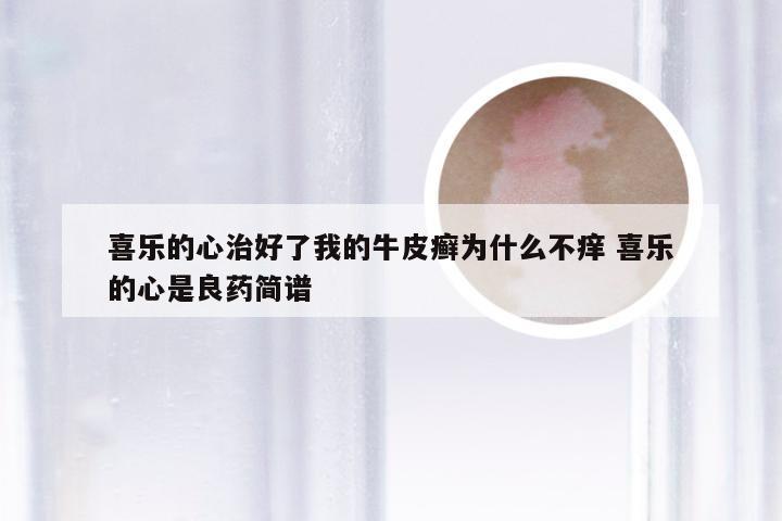 喜乐的心治好了我的牛皮癣为什么不痒 喜乐的心是良药简谱
