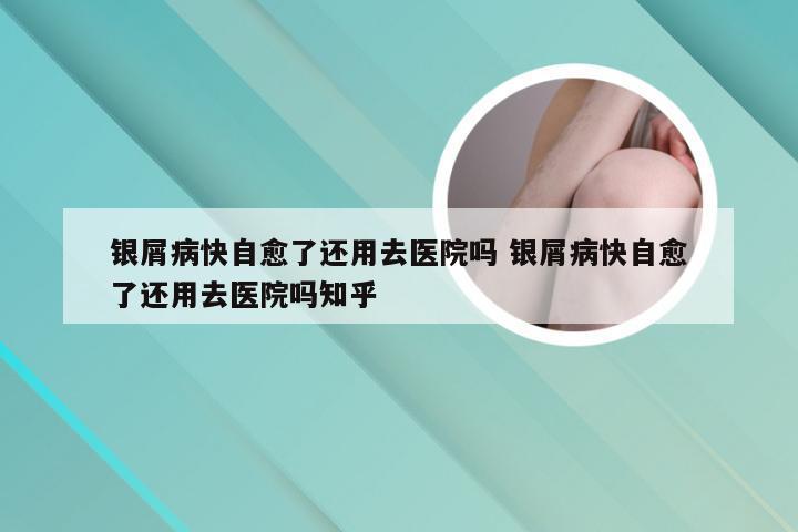 银屑病快自愈了还用去医院吗 银屑病快自愈了还用去医院吗知乎