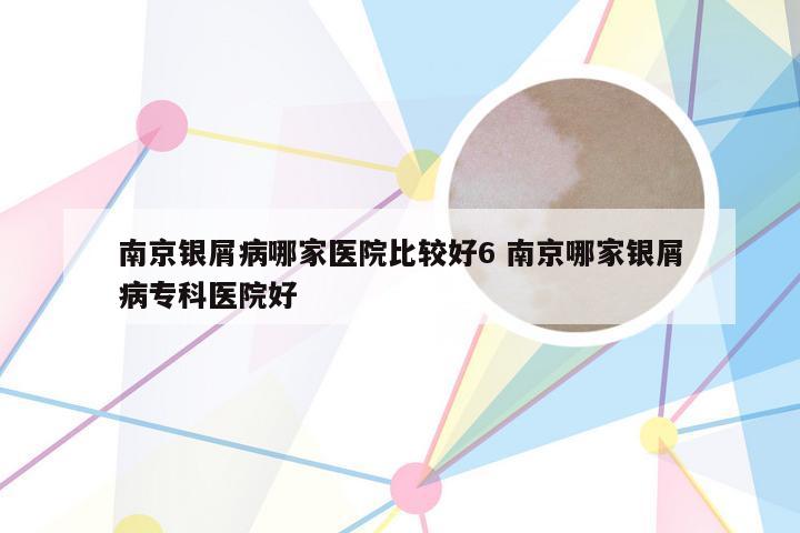 南京银屑病哪家医院比较好6 南京哪家银屑病专科医院好