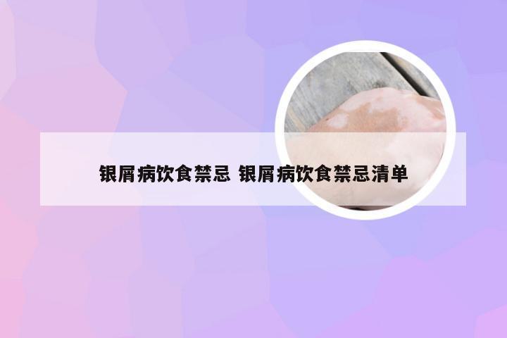 银屑病饮食禁忌 银屑病饮食禁忌清单