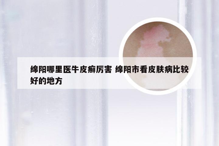 绵阳哪里医牛皮癣厉害 绵阳市看皮肤病比较好的地方