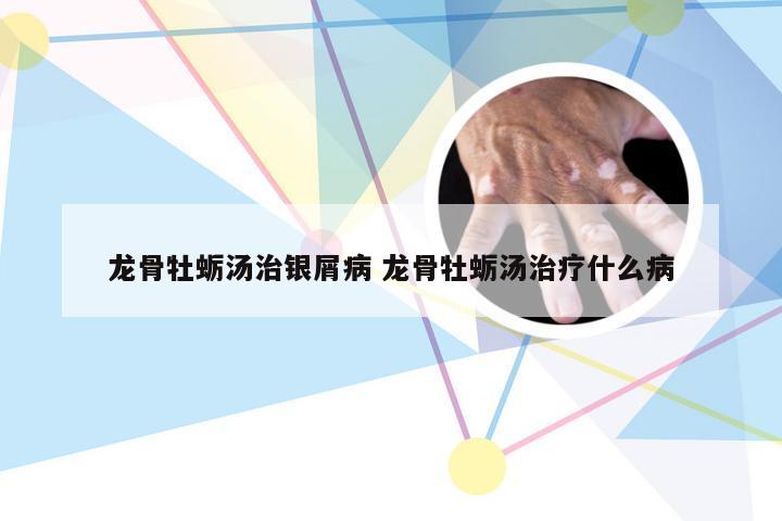 龙骨牡蛎汤治银屑病 龙骨牡蛎汤治疗什么病
