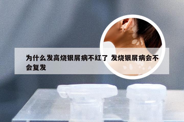 为什么发高烧银屑病不红了 发烧银屑病会不会复发