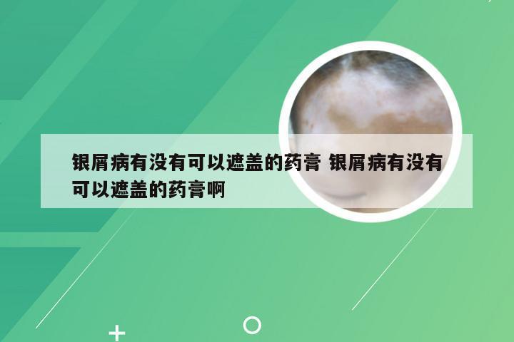 银屑病有没有可以遮盖的药膏 银屑病有没有可以遮盖的药膏啊