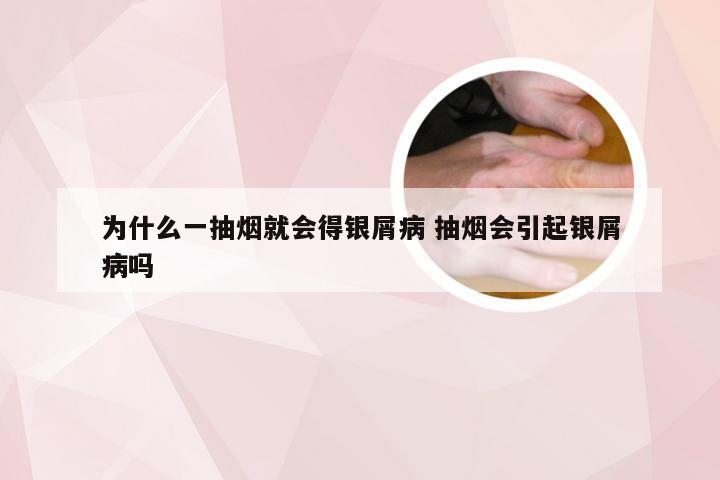 为什么一抽烟就会得银屑病 抽烟会引起银屑病吗