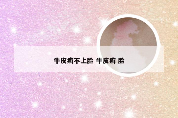 牛皮癣不上脸 牛皮癣 脸