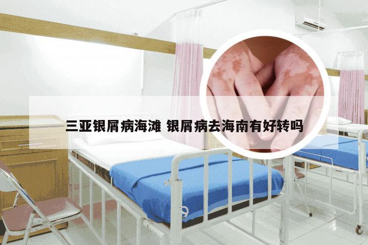 三亚银屑病海滩 银屑病去海南有好转吗