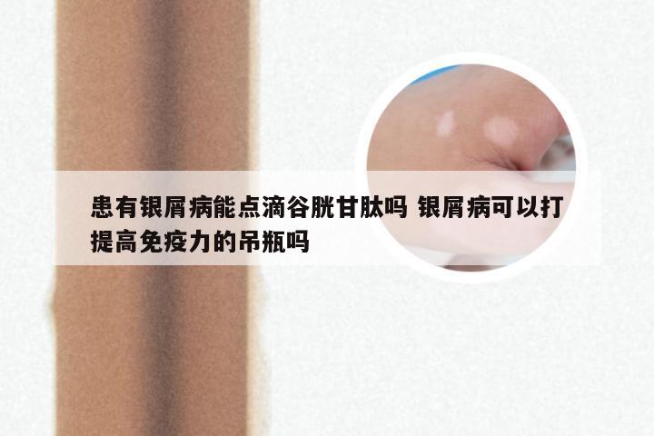 患有银屑病能点滴谷胱甘肽吗 银屑病可以打提高免疫力的吊瓶吗