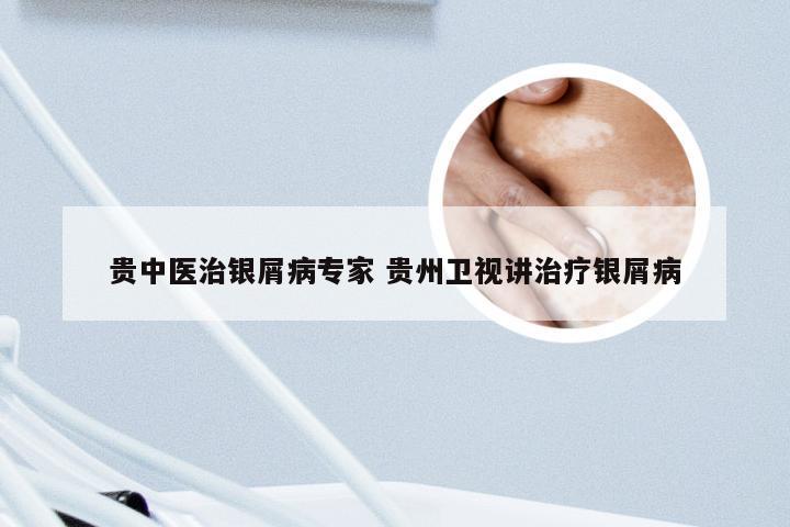 贵中医治银屑病专家 贵州卫视讲治疗银屑病