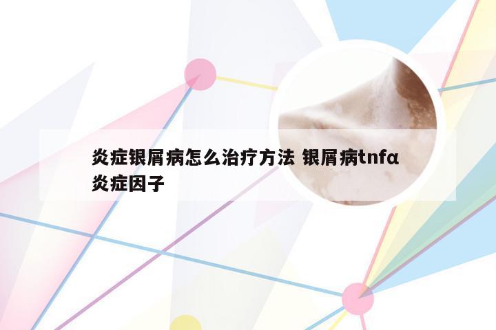 炎症银屑病怎么治疗方法 银屑病tnfα 炎症因子