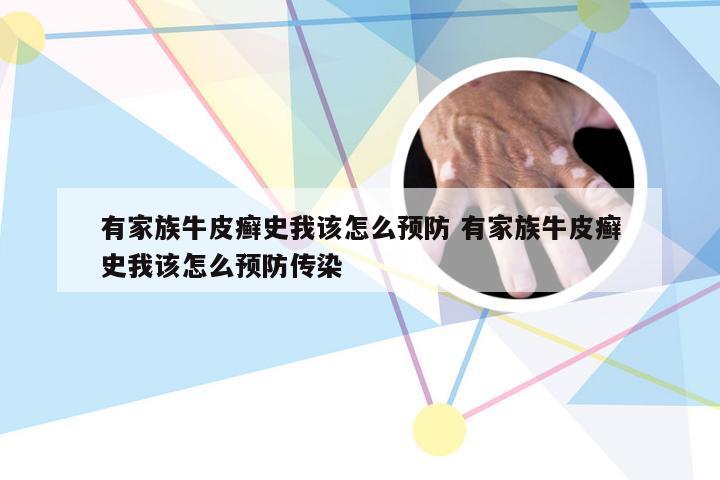 有家族牛皮癣史我该怎么预防 有家族牛皮癣史我该怎么预防传染