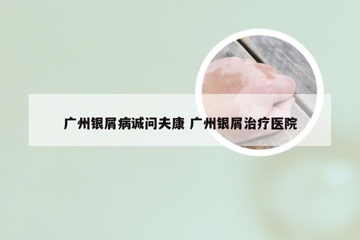 广州银屑病诚问夫康 广州银屑治疗医院