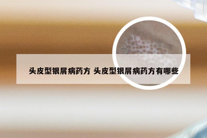 头皮型银屑病药方 头皮型银屑病药方有哪些
