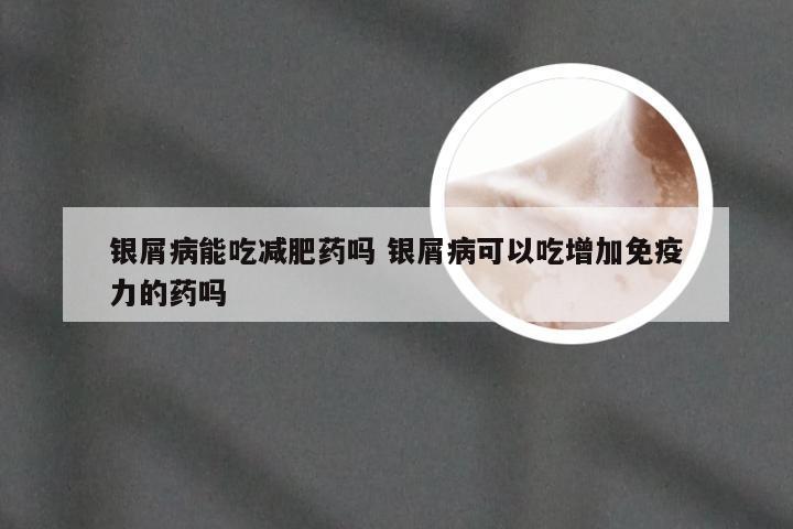 银屑病能吃减肥药吗 银屑病可以吃增加免疫力的药吗