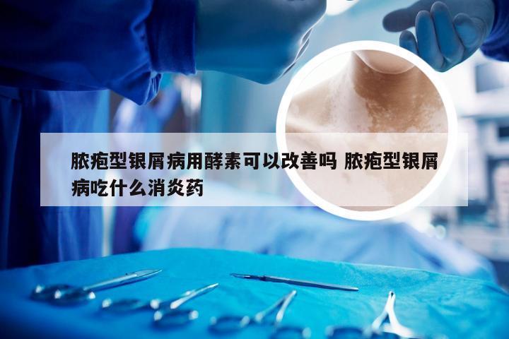 脓疱型银屑病用酵素可以改善吗 脓疱型银屑病吃什么消炎药