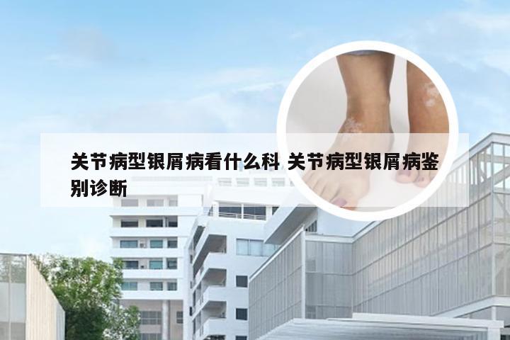 关节病型银屑病看什么科 关节病型银屑病鉴别诊断