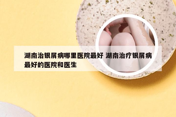 湖南治银屑病哪里医院最好 湖南治疗银屑病最好的医院和医生