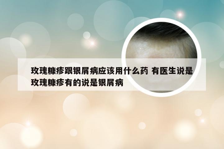 玫瑰糠疹跟银屑病应该用什么药 有医生说是玫瑰糠疹有的说是银屑病