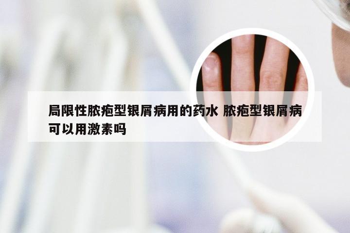 局限性脓疱型银屑病用的药水 脓疱型银屑病可以用激素吗