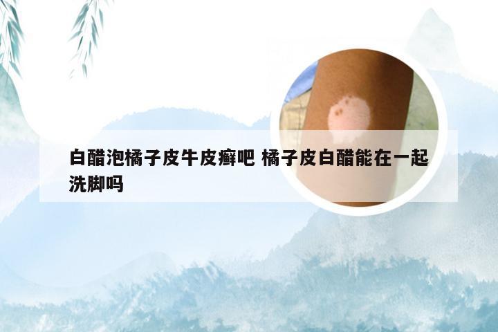 白醋泡橘子皮牛皮癣吧 橘子皮白醋能在一起洗脚吗