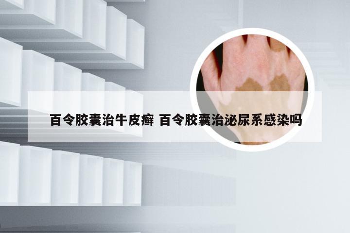 百令胶囊治牛皮癣 百令胶囊治泌尿系感染吗