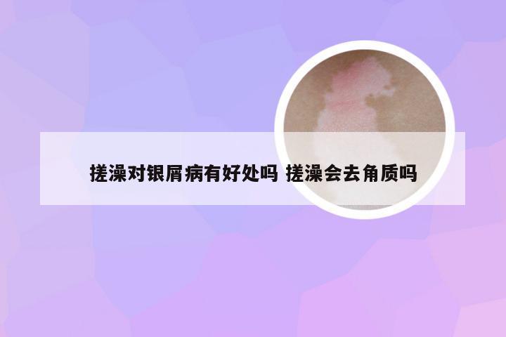 搓澡对银屑病有好处吗 搓澡会去角质吗