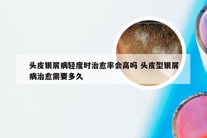 头皮银屑病轻度时治愈率会高吗 头皮型银屑病治愈需要多久