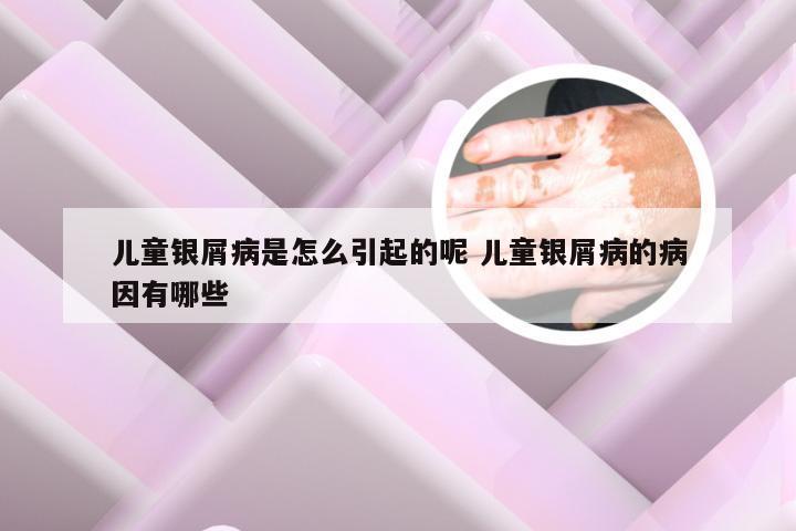 儿童银屑病是怎么引起的呢 儿童银屑病的病因有哪些