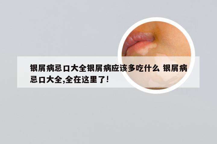 银屑病忌口大全银屑病应该多吃什么 银屑病忌口大全,全在这里了!