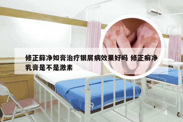 修正藓净如膏治疗银屑病效果好吗 修正癣净乳膏是不是激素