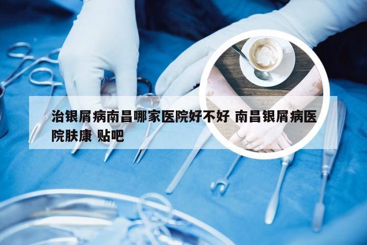 治银屑病南昌哪家医院好不好 南昌银屑病医院肤康 贴吧