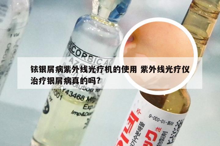 铱银屑病紫外线光疗机的使用 紫外线光疗仪治疗银屑病真的吗?