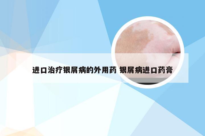 进口治疗银屑病的外用药 银屑病进口药膏