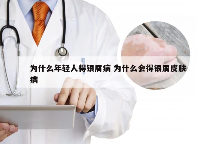 为什么年轻人得银屑病 为什么会得银屑皮肤病
