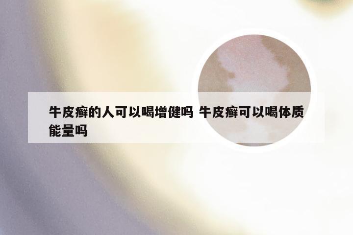 牛皮癣的人可以喝增健吗 牛皮癣可以喝体质能量吗