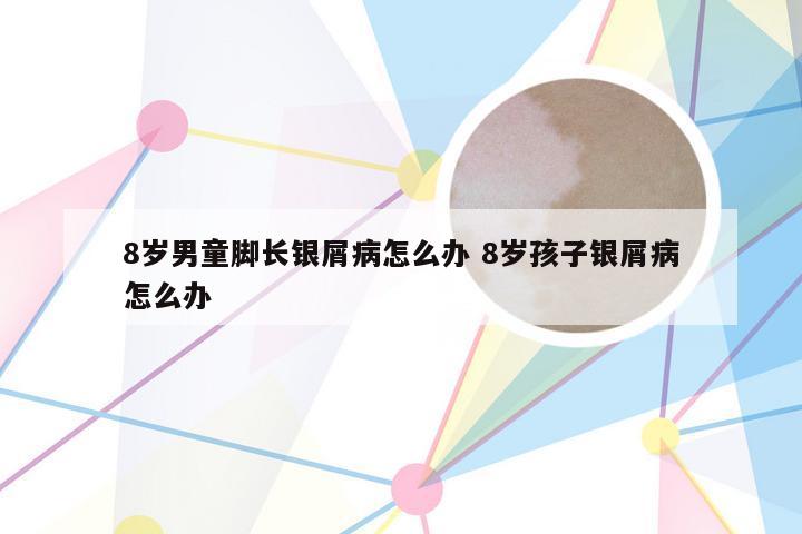 8岁男童脚长银屑病怎么办 8岁孩子银屑病怎么办