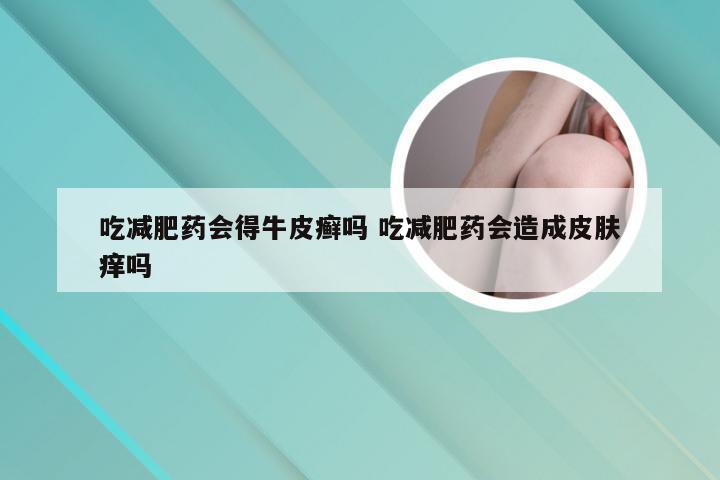 吃减肥药会得牛皮癣吗 吃减肥药会造成皮肤痒吗