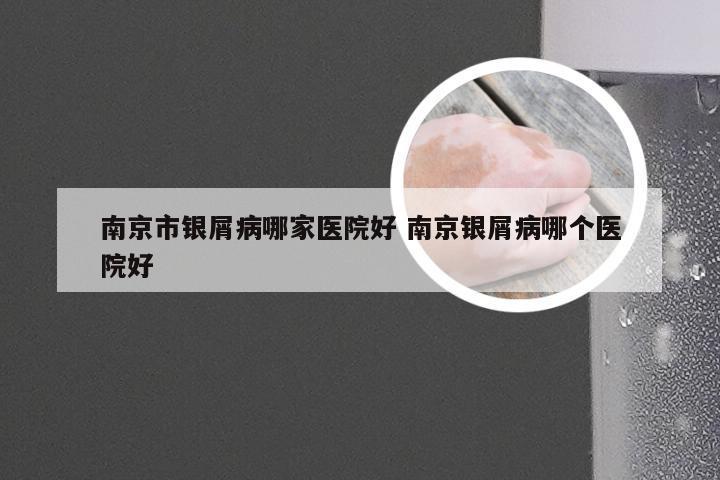 南京市银屑病哪家医院好 南京银屑病哪个医院好