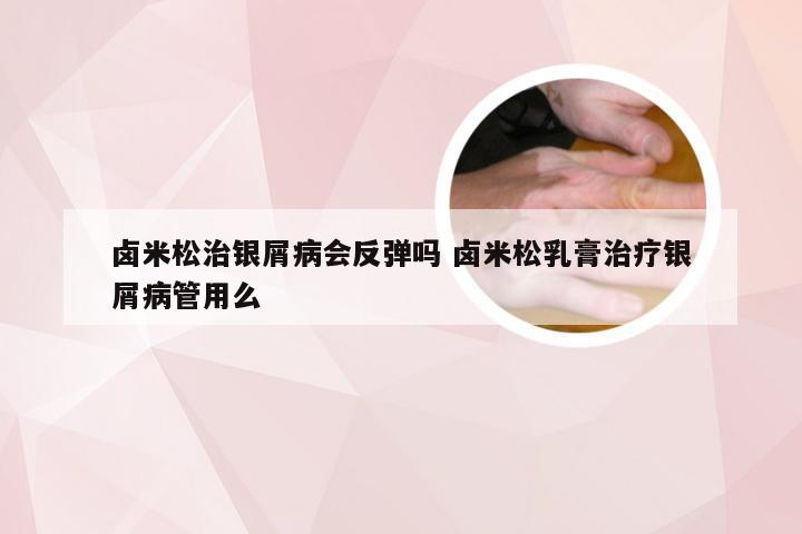 卤米松治银屑病会反弹吗 卤米松乳膏治疗银屑病管用么