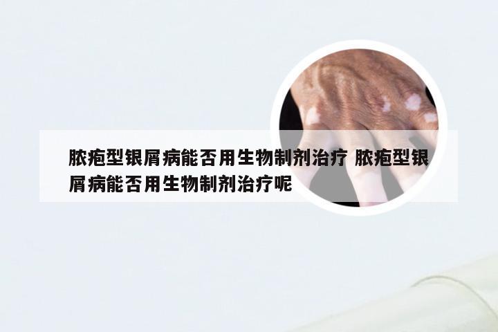 脓疱型银屑病能否用生物制剂治疗 脓疱型银屑病能否用生物制剂治疗呢
