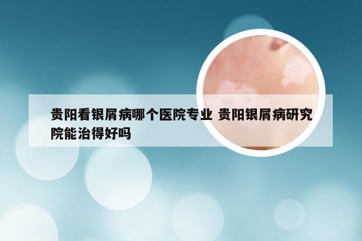 贵阳看银屑病哪个医院专业 贵阳银屑病研究院能治得好吗