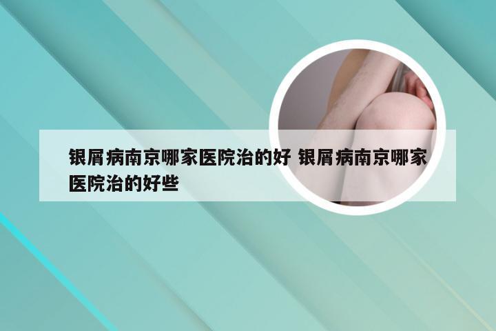 银屑病南京哪家医院治的好 银屑病南京哪家医院治的好些