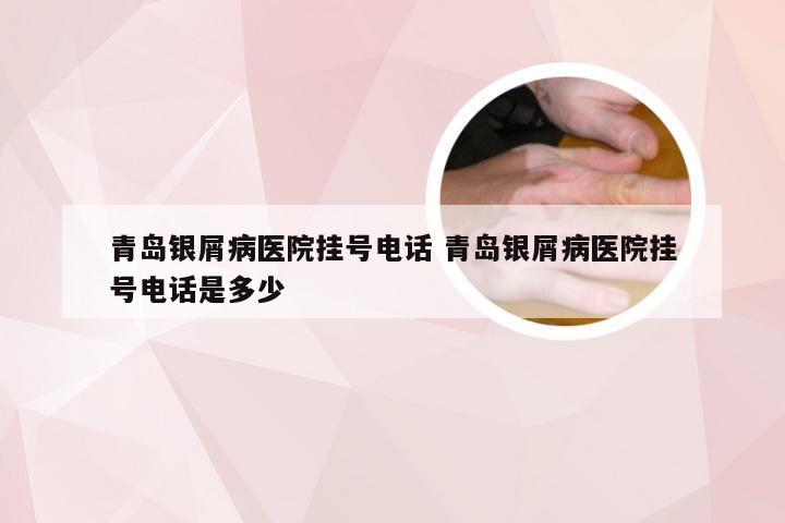青岛银屑病医院挂号电话 青岛银屑病医院挂号电话是多少