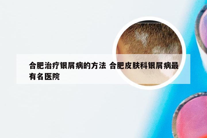 合肥治疗银屑病的方法 合肥皮肤科银屑病最有名医院