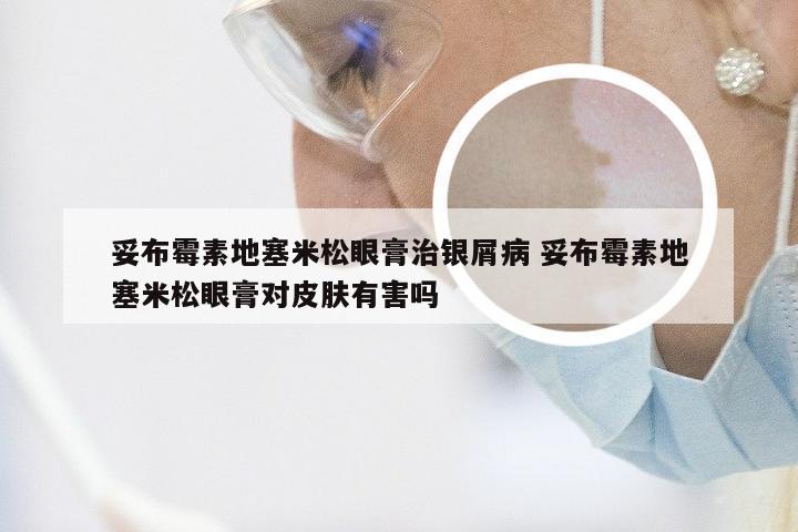 妥布霉素地塞米松眼膏治银屑病 妥布霉素地塞米松眼膏对皮肤有害吗
